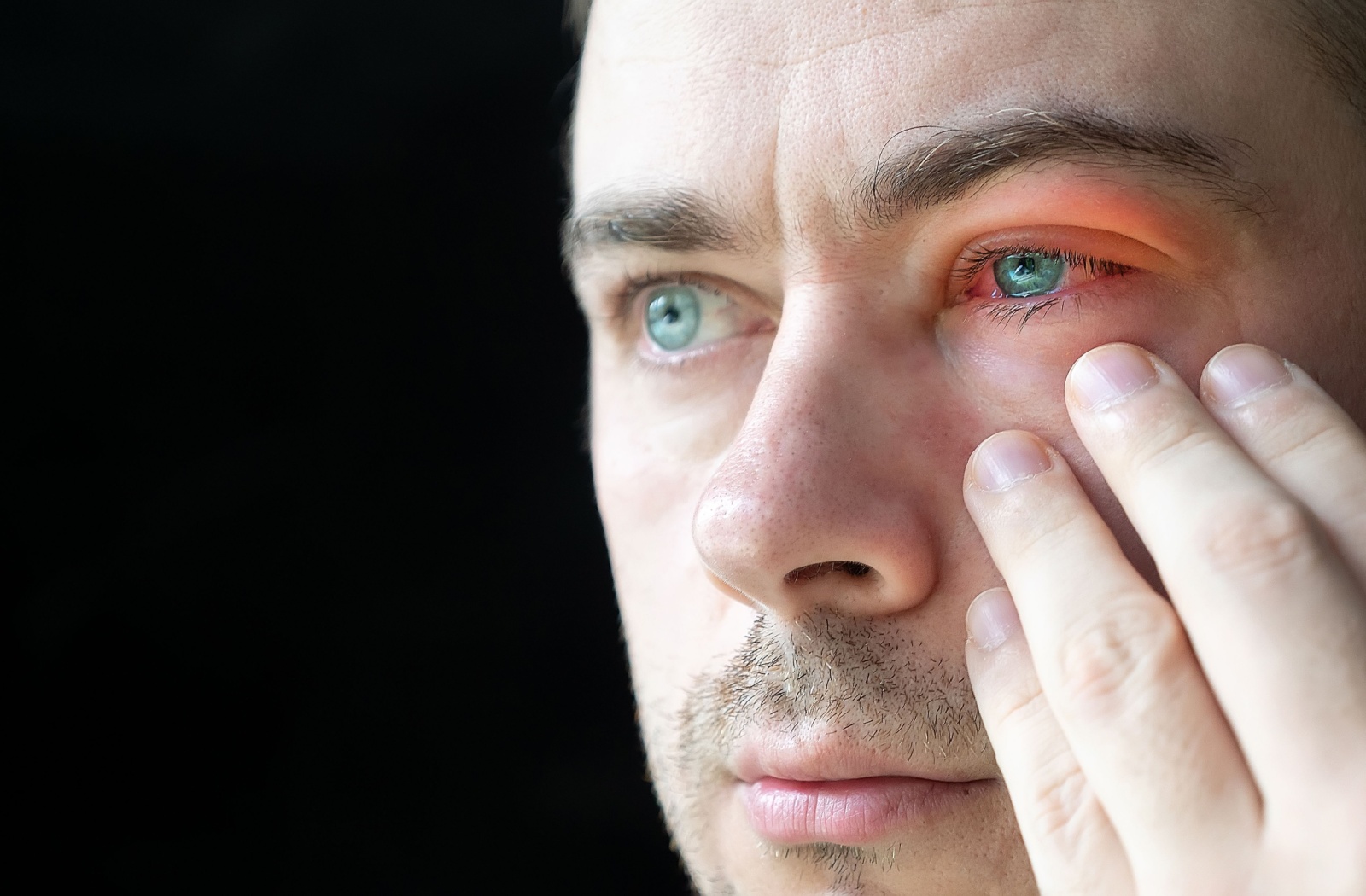 A person gently touches the area outside of their red, swollen eyelid.