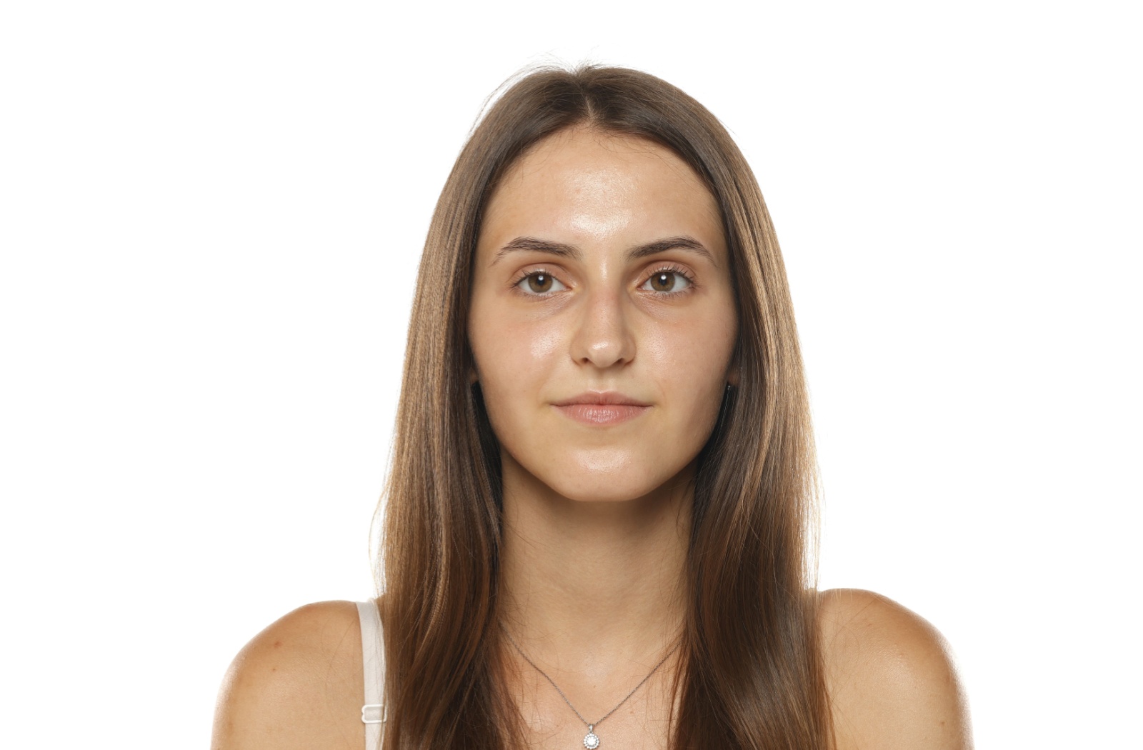 A young woman with slight eye misalignment looking straight ahead, illustrating a subtle difference in eye alignment that can contribute to visual discomfort or double vision.