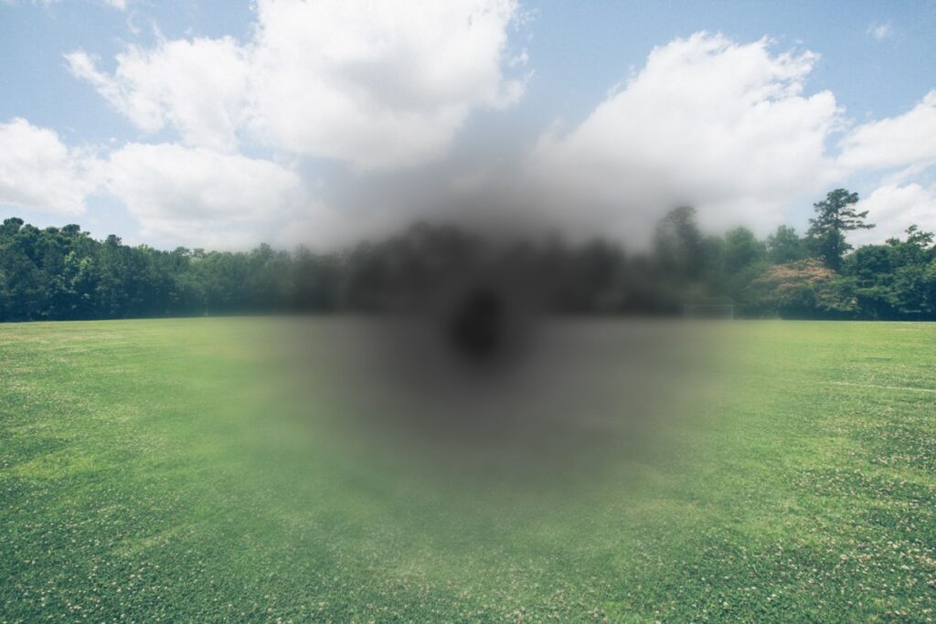 Vision simulation showing how macular degeneration affects sight with blurred and darkened central vision while viewing a park landscape with trees and grass.